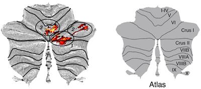 The impact of aging on morphometric changes in the cerebellum: A voxel-based morphometry study